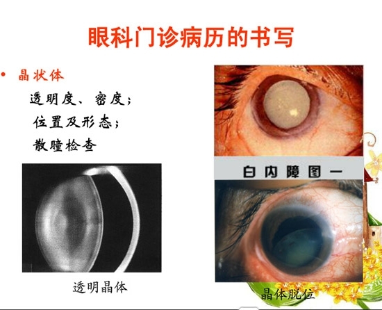 �ۿƲ�����������д