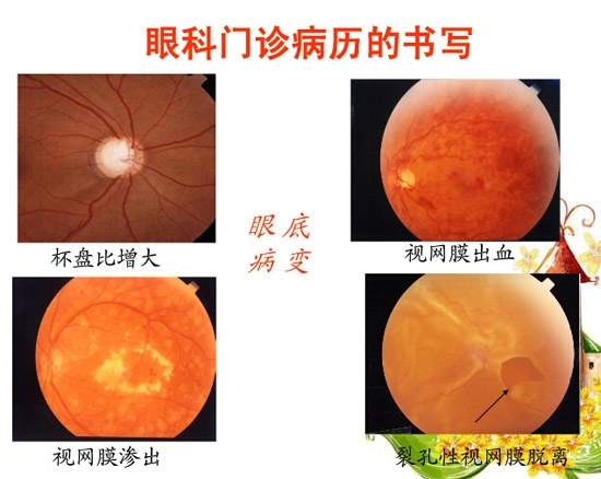 �ۿƲ�����������д