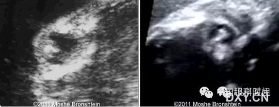 ̥�������ϳ������� 3 ��