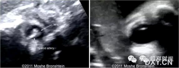 ̥�������ϳ������� 3 ��