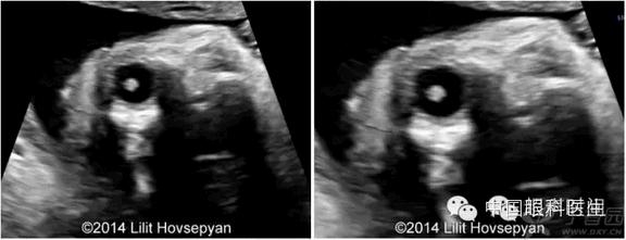 ̥�������ϳ������� 3 ��