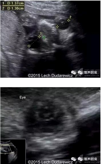 ̥�������ϳ������� 3 ��