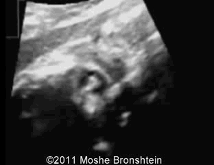 ̥�������ϳ������� 3 ��