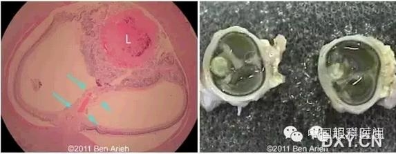 ̥�������ϳ������� 3 ��