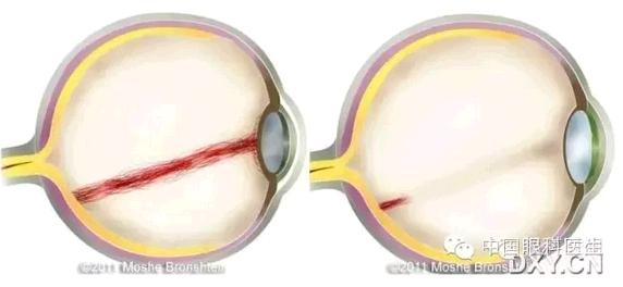 ̥�������ϳ������� 3 ��