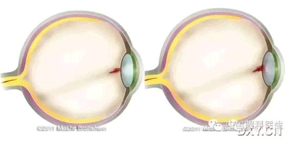 ̥�������ϳ������� 3 ��