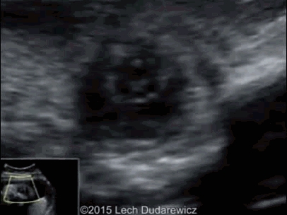 ̥�������ϳ������� 3 ��