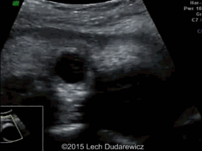 ̥�������ϳ������� 3 ��