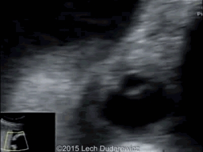 ̥�������ϳ������� 3 ��