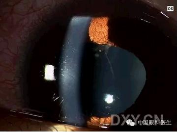 ��Щ�꣬�������������۲�������ͼ�׵ڶ�����