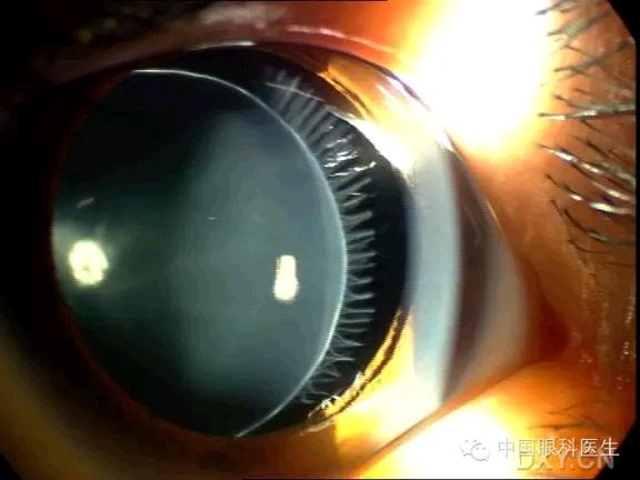 ��Щ�꣬�������������۲�������ͼ�׵ڶ�����