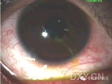 ��Щ�꣬�������������۲�������ͼ�׵ڶ�����