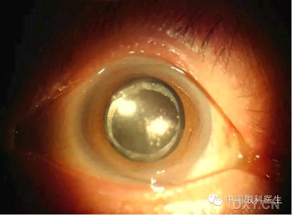 ��Щ�꣬�������������۲�������ͼ�׵ڶ�����