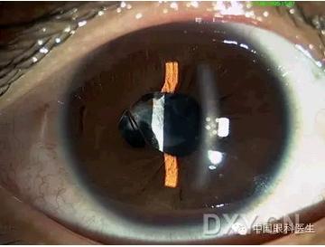 ��Щ�꣬�������������۲�������ͼ�׵ڶ�����