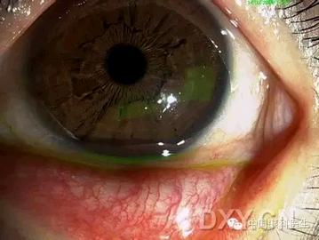 ��Щ�꣬�������������۲�������ͼ�׵ڶ�����