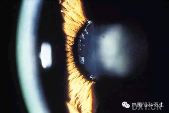 ��Щ�꣬�������������۲�������ͼ�׵ڶ�����