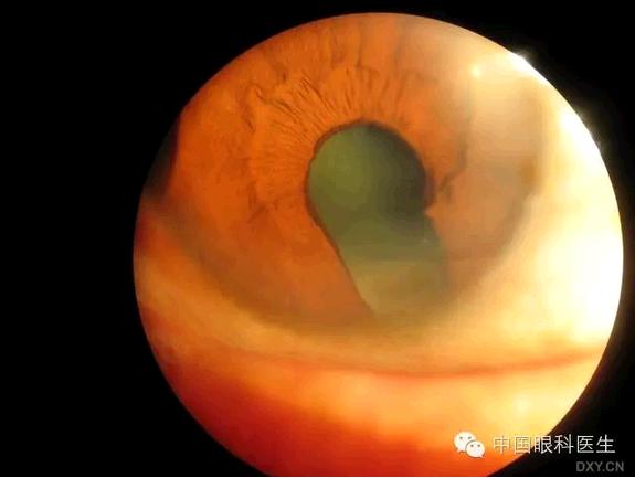 ��Щ�꣬�������������۲�������ͼ�׵ڶ�����