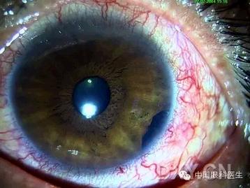 ��Щ�꣬�������������۲�������ͼ�׵ڶ�����