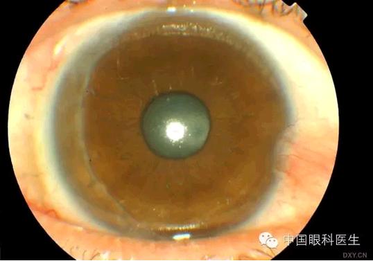 ��Щ�꣬�������������۲�������ͼ�׵ڶ�����