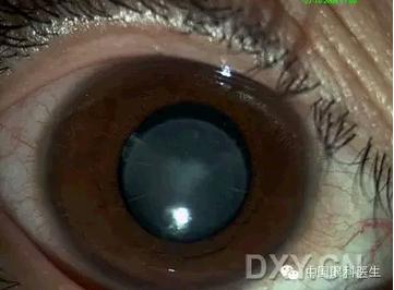 ��Щ�꣬�������������۲�������ͼ�׵ڶ�����