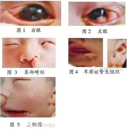 ���������������۲����Σ���������Եȱ�𣬲�����ȫ�պ�