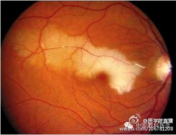 ���ò�����ͼƬ�������������ۿ�ҽ������Ȧ��������