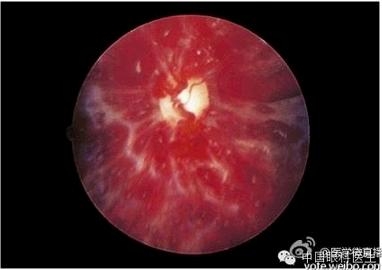 ���ò�����ͼƬ�������������ۿ�ҽ������Ȧ��������