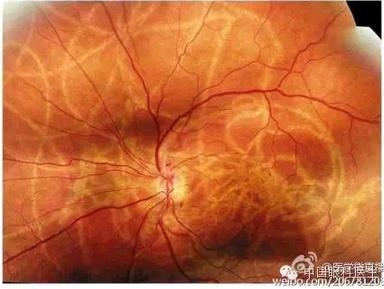 ���ò�����ͼƬ�������������ۿ�ҽ������Ȧ��������