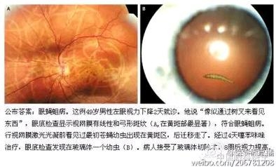 ���ò�����ͼƬ�������������ۿ�ҽ������Ȧ��������