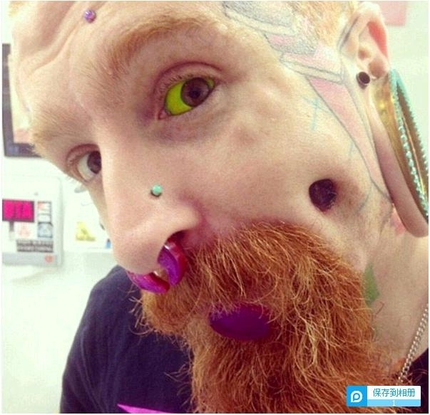 �Ĵ����������������� ����ʧ���Ͱ�֢����