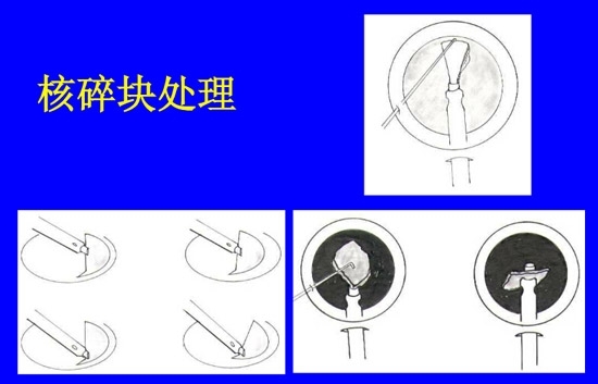 �����黯�����л�����������