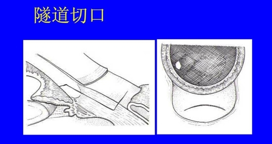 �����黯�����л�����������