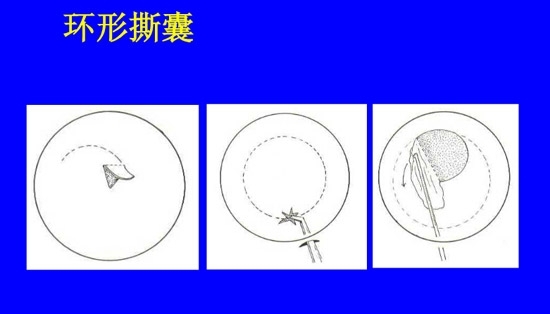 �����黯�����л�����������