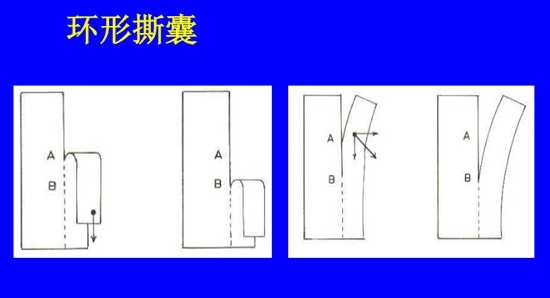 �����黯�����л�����������