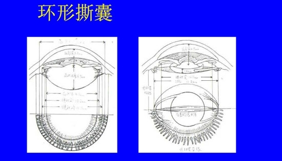 �����黯�����л�����������