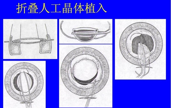 �����黯�����л�����������