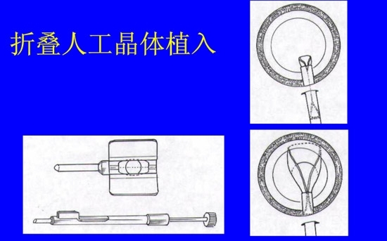 �����黯�����л�����������