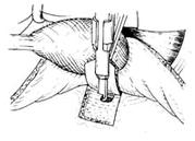 �����С���г�����ǰ�����С�����ȫ��ֱ��