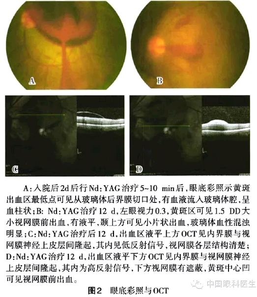 �������������������ǰ��Ӱ���������½�