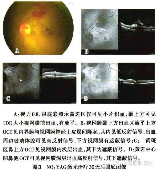 �������������������ǰ��Ӱ���������½�