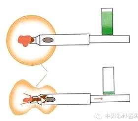 �����黯�Ĳ����趨����ͷѡ��