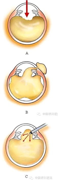 �����黯�Ĳ����趨����ͷѡ��