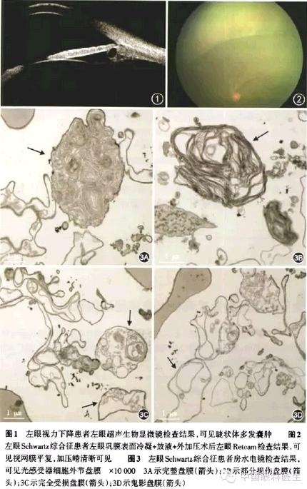 �����������������½�����Ĥ��ȳ�Ѫ����Ĥ��״ˮ�ף�ǰ������