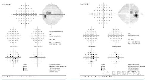 ��������35�����Ի��߳��������½�