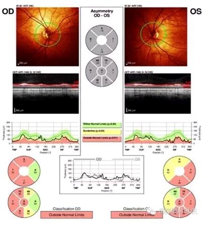 ��������35�����Ի��߳��������½�