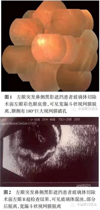 ���������������г����б���������Ĥ��Ѫ