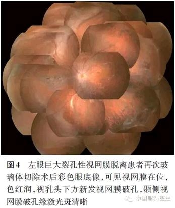 ���������������г����б���������Ĥ��Ѫ