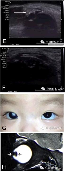 ��������Ӥ�����ڼ���άĸϸ����һ��