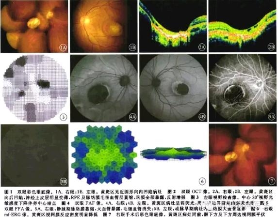 ������������Ĥ����ĤӪ�������ϲ�����Ĥ����һ��