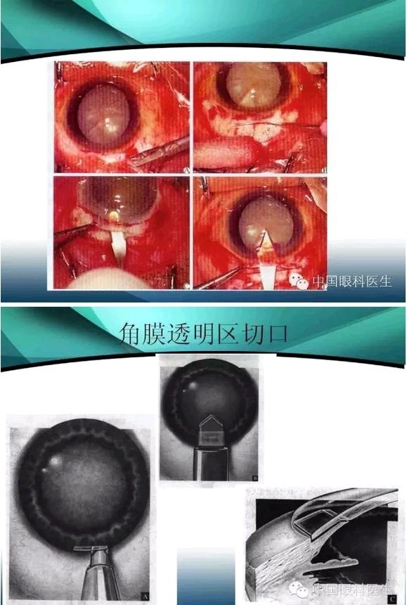 ���������������󲢷�֢��������ѧ�߱ر��ؼ���